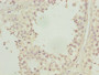 Immunohistochemistry of paraffin-embedded human testis tissue using CAC08277 at dilution of 1:100
