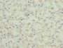 Immunohistochemistry of paraffin-embedded human gastric cancer using CAC08286 at dilution of 1:100
