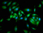 Immunofluorescence staining of A549 cells with CAC08287 at 1:166, counter-stained with DAPI. The cells were fixed in 4% formaldehyde, permeabilized using 0.2% Triton X-100 and blocked in 10% normal Goat Serum. The cells were then incubated with the antibody overnight at 4°C. The secondary antibody was Alexa Fluor 488-congugated AffiniPure Goat Anti-Rabbit IgG(H+L).