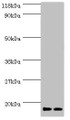 Western blot; All lanes: RPS19 antibody at 2µg/ml; Lane 1: EC109 whole cell lysate; Lane 2: 293T whole cell lysate; Secondary; Goat polyclonal to rabbit IgG at 1/15000 dilution; Predicted band size: 17 kDa; Observed band size: 17 kDa