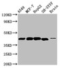 Western Blot; Positive WB detected in: A549 whole cell lysate, MCF-7 whole cell lysate, HepG2 whole cell lysate, SH-SY5Y whole cell lysate, Rat brain tissue; All lanes: DLK1 antibody at 4.6µg/ml; Secondary; Goat polyclonal to rabbit IgG at 1/50000 dilution; Predicted band size: 42, 34 kDa; Observed band size: 42 kDa Western Blot; Positive WB detected in: A549 whole cell lysate, MCF-7 whole cell lysate, HepG2 whole cell lysate, SH-SY5Y whole cell lysate, Rat brain tissue; All lanes: DLK1 antibody at 4.6µg/ml; Secondary; Goat polyclonal to rabbit IgG at 1/50000 dilution; Predicted band size: 42, 34 kDa; Observed band size: 42 kDa