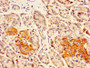 IHC image diluted at 1:300 and staining in paraffin-embedded human pancreatic tissue performed on a Leica BondTM system. After dewaxing and hydration, antigen retrieval was mediated by high pressure in a citrate buffer (pH 6.0). Section was blocked with 10% normal goat serum 30min at RT. Then primary antibody (1% BSA) was incubated at 4°C overnight. The primary is detected by a biotinylated secondary antibody and visualized using an HRP conjugated SP system. IHC image diluted at 1:300 and staining in paraffin-embedded human pancreatic tissue performed on a Leica BondTM system. After dewaxing and hydration, antigen retrieval was mediated by high pressure in a citrate buffer (pH 6.0). Section was blocked with 10% normal goat serum 30min at RT. Then primary antibody (1% BSA) was incubated at 4°C overnight. The primary is detected by a biotinylated secondary antibody and visualized using an HRP conjugated SP system.