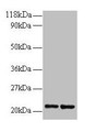 Western blot; All lanes: RPS9 antibody at 2µg/ml; Lane 1: 293T whole cell lysate; Lane 2: EC109 whole cell lysate; Secondary; Goat polyclonal to rabbit IgG at 1/15000 dilution; Predicted band size: 21 kDa; Observed band size: 21 kDa