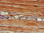IHC image diluted at 1:400 and staining in paraffin-embedded human skeletal muscle tissue performed on a Leica BondTM system. After dewaxing and hydration, antigen retrieval was mediated by high pressure in a citrate buffer (pH 6.0). Section was blocked with 10% normal goat serum 30min at RT. Then primary antibody (1% BSA) was incubated at 4°C overnight. The primary is detected by a biotinylated secondary antibody and visualized using an HRP conjugated SP system.