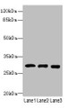 Western blot; All lanes: CELA3A antibody at 14µg/ml; Lane 1: Mouse heart tissue; Lane 2: Mouse skeletal muscle tissue; Lane 3: Jurkat whole cell lysate; Secondary; Goat polyclonal to rabbit IgG at 1/10000 dilution; Predicted band size: 30 kDa; Observed band size: 30 kDa