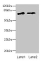 Western blot; All lanes: ENOX1 antibody at 5µg/ml; Lane 1: Jurkat whole cell lysate; Lane 2: Raji whole cell lysate; Secondary; Goat polyclonal to rabbit IgG at 1/10000 dilution; Predicted band size: 74, 28 kDa; Observed band size: 74 kDa