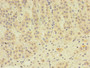 Immunohistochemistry of paraffin-embedded human adrenal gland tissue using CAC08405 at dilution of 1:100 Immunohistochemistry of paraffin-embedded human adrenal gland tissue using CAC08405 at dilution of 1:100