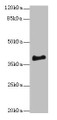 Western blot; All lanes: ERLIN1 antibody at 4µg/ml + Mouse brain tissue; Secondary; Goat polyclonal to rabbit IgG at 1/10000 dilution; Predicted band size: 39 kDa; Observed band size: 39 kDa