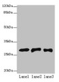 Western blot; All lanes: ETHE1 antibody at 8µg/ml; Lane 1: Mouse liver tissue; Lane 2: HepG2 whole cell lysate; Lane 3: Hela whole cell lysate; Secondary; Goat polyclonal to rabbit IgG at 1/10000 dilution; Predicted band size: 28 kDa; Observed band size: 28 kDa Western blot; All lanes: ETHE1 antibody at 8µg/ml; Lane 1: Mouse liver tissue; Lane 2: HepG2 whole cell lysate; Lane 3: Hela whole cell lysate; Secondary; Goat polyclonal to rabbit IgG at 1/10000 dilution; Predicted band size: 28 kDa; Observed band size: 28 kDa