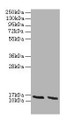 Western blot; All lanes: Hba antibody at 2µg/ml; Lane 1: HepG2 whole cell lysate; Lane 2: Hela whole cell lysate; Secondary; Goat polyclonal to rabbit IgG at 1/10000 dilution; Predicted band size: 16 kDa; Observed band size: 16 kDa