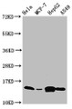Western Blot; Positive WB detected in: Hela whole cell lysate, MCF-7 whole cell lysate, HepG2 whole cell lysate, A549 whole cell lysate; All lanes: IFITM2 antibody at 4.7µg/ml; Secondary; Goat polyclonal to rabbit IgG at 1/50000 dilution; Predicted band size: 15 kDa; Observed band size: 15 kDa Western Blot; Positive WB detected in: Hela whole cell lysate, MCF-7 whole cell lysate, HepG2 whole cell lysate, A549 whole cell lysate; All lanes: IFITM2 antibody at 4.7µg/ml; Secondary; Goat polyclonal to rabbit IgG at 1/50000 dilution; Predicted band size: 15 kDa; Observed band size: 15 kDa