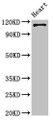 Western Blot; Positive WB detected in: Mouse heart tissue; All lanes: ITGA5 antibody at 4µg/ml; Secondary; Goat polyclonal to rabbit IgG at 1/50000 dilution; Predicted band size: 115 kDa; Observed band size: 115 kDa;