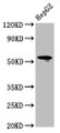 Western Blot; Positive WB detected in: HepG2 whole cell lysate; All lanes: LAG3 antibody at 4.9µg/ml; Secondary; Goat polyclonal to rabbit IgG at 1/50000 dilution; Predicted band size: 58, 40 kDa; Observed band size: 58 kDa