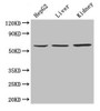 Western Blot; Positive WB detected in: HepG2 whole cell lysate, Mouse liver tissue, Mouse kidney tissue; All lanes: NAPRT antibody at 4µg/ml; Secondary; Goat polyclonal to rabbit IgG at 1/10000 dilution; Predicted band size: 58, 61, 57 kDa; Observed band size: 58 kDa
