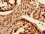 IHC image diluted at 1:600 and staining in paraffin-embedded human testis tissue performed on a Leica BondTM system. After dewaxing and hydration, antigen retrieval was mediated by high pressure in a citrate buffer (pH 6.0). Section was blocked with 10% normal goat serum 30min at RT. Then primary antibody (1% BSA) was incubated at 4°C overnight. The primary is detected by a biotinylated secondary antibody and visualized using an HRP conjugated SP system.