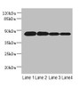 Western blot; All lanes: PCOLCE2 antibody at 8µg/ml; Lane 1: MCF-7 whole cell lysate; Lane 2: A549 whole cell lysate; Lane 3: HCT116 whole cell lysate; Lane 4: Human high value serum; Secondary; Goat polyclonal to rabbit IgG at 1/10000 dilution; Predicted band size: 46 kDa; Observed band size: 46 kDa Western blot; All lanes: PCOLCE2 antibody at 8µg/ml; Lane 1: MCF-7 whole cell lysate; Lane 2: A549 whole cell lysate; Lane 3: HCT116 whole cell lysate; Lane 4: Human high value serum; Secondary; Goat polyclonal to rabbit IgG at 1/10000 dilution; Predicted band size: 46 kDa; Observed band size: 46 kDa