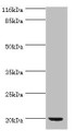 Western blot; All lanes: def antibody at 2µg/ml + DH5a whole cell lysate; Secondary; Goat polyclonal to rabbit IgG at 1/10000 dilution; Predicted band size: 20 kDa; Observed band size: 20 kDa