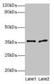 Western blot; All lanes: Plaur antibody at 2µg/ml; Lane 1: 293T whole cell lysate; Lane 2: Rat brain tissue; Secondary; Goat polyclonal to rabbit IgG at 1/10000 dilution; Predicted band size: 36, 25 kDa; Observed band size: 36 kDa