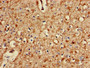 Immunohistochemistry of paraffin-embedded human brain tissue using CAC08763 at dilution of 1:100 Immunohistochemistry of paraffin-embedded human brain tissue using CAC08763 at dilution of 1:100
