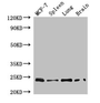 Western Blot; Positive WB detected in: MCF-7 whole cell lysate, Mouse spleen tissue, Mouse lung tissue, Mouse brain tissue; All lanes: RAB25 antibody at 4µg/ml; Secondary; Goat polyclonal to rabbit IgG at 1/50000 dilution; Predicted band size: 24 kDa; Observed band size: 24 kDa
