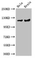 Western Blot; Positive WB detected in: Hela whole cell lysate, Mouse brain tissue; All lanes: RASA1 antibody at 3.5µg/ml; Secondary; Goat polyclonal to rabbit IgG at 1/50000 dilution; Predicted band size: 117, 101, 59, 102 kDa; Observed band size: 117 kDa