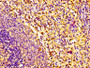 IHC image of CAC08801 diluted at 1:100 and staining in paraffin-embedded human spleen tissue performed on a Leica BondTM system. After dewaxing and hydration, antigen retrieval was mediated by high pressure in a citrate buffer (pH 6.0). Section was blocked with 10% normal goat serum 30min at RT. Then primary antibody (1% BSA) was incubated at 4°C overnight. The primary is detected by a biotinylated secondary antibody and visualized using an HRP conjugated SP system. IHC image of CAC08801 diluted at 1:100 and staining in paraffin-embedded human spleen tissue performed on a Leica BondTM system. After dewaxing and hydration, antigen retrieval was mediated by high pressure in a citrate buffer (pH 6.0). Section was blocked with 10% normal goat serum 30min at RT. Then primary antibody (1% BSA) was incubated at 4°C overnight. The primary is detected by a biotinylated secondary antibody and visualized using an HRP conjugated SP system.