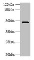 Western blot; All lanes: RNF26 antibody at 6µg/ml + 293T whole cell lysate; Secondary; Goat polyclonal to rabbit IgG at 1/10000 dilution; Predicted band size: 48 kDa; Observed band size: 48 kDa