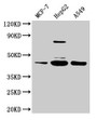 Western Blot; Positive WB detected in: MCF-7 whole cell lysate, HepG2 whole cell lysate, A549 whole cell lysate; All lanes: SERPINB1 antibody at 2µg/ml; Secondary; Goat polyclonal to rabbit IgG at 1/50000 dilution; Predicted band size: 43, 27 kDa; Observed band size: 43 kDa Western Blot; Positive WB detected in: MCF-7 whole cell lysate, HepG2 whole cell lysate, A549 whole cell lysate; All lanes: SERPINB1 antibody at 2µg/ml; Secondary; Goat polyclonal to rabbit IgG at 1/50000 dilution; Predicted band size: 43, 27 kDa; Observed band size: 43 kDa