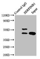 Immunoprecipitating SERPINB1 in HepG2 whole cell lysate; , Lane 1: Rabbit control IgG instead in HepG2 whole cell lysate. For western blotting, a HRP-conjugated Protein G antibody was used as the secondary antibody (1/2000); , Lane 2: CAC08835 (8µg) + HepG2 whole cell lysate (500µg); , Lane 3: HepG2 whole cell lysate (20µg) Immunoprecipitating SERPINB1 in HepG2 whole cell lysate; , Lane 1: Rabbit control IgG instead in HepG2 whole cell lysate. For western blotting, a HRP-conjugated Protein G antibody was used as the secondary antibody (1/2000); , Lane 2: CAC08835 (8µg) + HepG2 whole cell lysate (500µg); , Lane 3: HepG2 whole cell lysate (20µg)