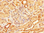 IHC image diluted at 1:200 and staining in paraffin-embedded human kidney tissue performed on a Leica BondTM system. After dewaxing and hydration, antigen retrieval was mediated by high pressure in a citrate buffer (pH 6.0). Section was blocked with 10% normal goat serum 30min at RT. Then primary antibody (1% BSA) was incubated at 4°C overnight. The primary is detected by a biotinylated secondary antibody and visualized using an HRP conjugated SP system. IHC image diluted at 1:200 and staining in paraffin-embedded human kidney tissue performed on a Leica BondTM system. After dewaxing and hydration, antigen retrieval was mediated by high pressure in a citrate buffer (pH 6.0). Section was blocked with 10% normal goat serum 30min at RT. Then primary antibody (1% BSA) was incubated at 4°C overnight. The primary is detected by a biotinylated secondary antibody and visualized using an HRP conjugated SP system.