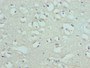 Immunohistochemistry of paraffin-embedded human brain tissue using CAC08848 at dilution of 1:100 Immunohistochemistry of paraffin-embedded human brain tissue using CAC08848 at dilution of 1:100