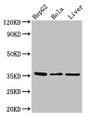 Western Blot; , Positive WB detected in: HepG2 whole cell lysate, Hela whole cell lysate, Mouse liver tissue; , All lanes: SPRY1 antibody at 2.7µg/ml; , Secondary; , Goat polyclonal to rabbit IgG at 1/50000 dilution; , Predicted band size: 36 kDa; , Observed band size: 36 kDa Western Blot; , Positive WB detected in: HepG2 whole cell lysate, Hela whole cell lysate, Mouse liver tissue; , All lanes: SPRY1 antibody at 2.7µg/ml; , Secondary; , Goat polyclonal to rabbit IgG at 1/50000 dilution; , Predicted band size: 36 kDa; , Observed band size: 36 kDa