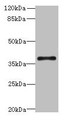 Western blot; All lanes: SUCNR1 antibody at 6µg/ml + Hela whole cell lysate; Secondary; Goat polyclonal to rabbit IgG at 1/10000 dilution; Predicted band size: 39 kDa; Observed band size: 39 kDa Western blot; All lanes: SUCNR1 antibody at 6µg/ml + Hela whole cell lysate; Secondary; Goat polyclonal to rabbit IgG at 1/10000 dilution; Predicted band size: 39 kDa; Observed band size: 39 kDa
