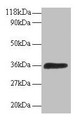 Western blot; All lanes: ATP6V1E1 antibody at 2µg/ml + 293T whole cell lysate; Secondary; Goat polyclonal to rabbit IgG at 1/15000 dilution; Predicted band size: 27, 24, 23 kDa; Observed band size: 36 kDa