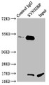 Immunoprecipitating SYNJ2BP in Rat kidney tissue; Lane 1: Rabbit control IgG instead of CAC08889 in Rat kidney tissue. For western blotting, a HRP-conjugated light chain specific antibody was used as the secondary antibody (1/50000); Lane 2: CAC08889 (6µg) + Rat kidney tissue (500µg); Lane 3: Rat kidney tissue (20µg) Immunoprecipitating SYNJ2BP in Rat kidney tissue; Lane 1: Rabbit control IgG instead of CAC08889 in Rat kidney tissue. For western blotting, a HRP-conjugated light chain specific antibody was used as the secondary antibody (1/50000); Lane 2: CAC08889 (6µg) + Rat kidney tissue (500µg); Lane 3: Rat kidney tissue (20µg)