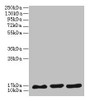 Western blot; ,All lanes: SYNJ2BP antibody at 3µg/ml; ,Lane 1: MCF-7 whole cell lysate; ,Lane 2: U251 whole cell lysate; ,Lane 3: Caco-2 whole cell lysate; ,Secondary; ,Goat polyclonal to rabbit IgG at 1/10000 dilution; ,Predicted band size: 16 kDa; ,Observed band size: 16 kDa; ,; , Western blot; ,All lanes: SYNJ2BP antibody at 3µg/ml; ,Lane 1: MCF-7 whole cell lysate; ,Lane 2: U251 whole cell lysate; ,Lane 3: Caco-2 whole cell lysate; ,Secondary; ,Goat polyclonal to rabbit IgG at 1/10000 dilution; ,Predicted band size: 16 kDa; ,Observed band size: 16 kDa; ,; ,