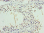 Immunohistochemistry of paraffin-embedded human testis tissue using CAC08889 at dilution of 1:100 Immunohistochemistry of paraffin-embedded human testis tissue using CAC08889 at dilution of 1:100