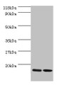 Western blot; All lanes: RPL27 antibody at 2µg/ml; Lane 1: EC109 whole cell lysate; Lane 2: 293T whole cell lysate; Secondary; Goat polyclonal to rabbit IgG at 1/15000 dilution; Predicted band size: 16 kDa; Observed band size: 16 kDa