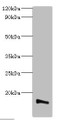 Western blot; All lanes: Transmembrane protein 14B antibody at 2µg/ml + K562 whole cell lysate; Secondary; Goat polyclonal to rabbit IgG at 1/10000 dilution; Predicted band size: 13, 9 kDa; Observed band size: 13 kDa; Western blot; All lanes: Transmembrane protein 14B antibody at 2µg/ml + K562 whole cell lysate; Secondary; Goat polyclonal to rabbit IgG at 1/10000 dilution; Predicted band size: 13, 9 kDa; Observed band size: 13 kDa;