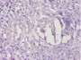 Immunohistochemistry of paraffin-embedded human kidney tissue using CAC08914 at dilution of 1:100 Immunohistochemistry of paraffin-embedded human kidney tissue using CAC08914 at dilution of 1:100