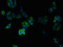 Immunofluorescent analysis of HepG2 cells using CAC08914 at dilution of 1:100 and Alexa Fluor 488-congugated AffiniPure Goat Anti-Rabbit IgG(H+L) Immunofluorescent analysis of HepG2 cells using CAC08914 at dilution of 1:100 and Alexa Fluor 488-congugated AffiniPure Goat Anti-Rabbit IgG(H+L)