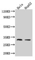 Western Blot; Positive WB detected in: Hela whole cell lysate, HepG2 whole cell lysate; All lanes: TMEM192 antibody at 3.2µg/ml; Secondary; Goat polyclonal to rabbit IgG at 1/50000 dilution; Predicted band size: 31 kDa; Observed band size: 31 kDa Western Blot; Positive WB detected in: Hela whole cell lysate, HepG2 whole cell lysate; All lanes: TMEM192 antibody at 3.2µg/ml; Secondary; Goat polyclonal to rabbit IgG at 1/50000 dilution; Predicted band size: 31 kDa; Observed band size: 31 kDa
