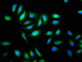 Immunofluorescence staining of A549 cells with CAC08920 at 1:133, counter-stained with DAPI. The cells were fixed in 4% formaldehyde, permeabilized using 0.2% Triton X-100 and blocked in 10% normal Goat Serum. The cells were then incubated with the antibody overnight at 4°C. The secondary antibody was Alexa Fluor 488-congugated AffiniPure Goat Anti-Rabbit IgG(H+L). Immunofluorescence staining of A549 cells with CAC08920 at 1:133, counter-stained with DAPI. The cells were fixed in 4% formaldehyde, permeabilized using 0.2% Triton X-100 and blocked in 10% normal Goat Serum. The cells were then incubated with the antibody overnight at 4°C. The secondary antibody was Alexa Fluor 488-congugated AffiniPure Goat Anti-Rabbit IgG(H+L).