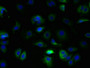 Immunofluorescent analysis of MCF-7 cells using CAC08955 at dilution of 1:100 and Alexa Fluor 488-congugated AffiniPure Goat Anti-Rabbit IgG(H+L) Immunofluorescent analysis of MCF-7 cells using CAC08955 at dilution of 1:100 and Alexa Fluor 488-congugated AffiniPure Goat Anti-Rabbit IgG(H+L)