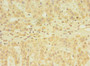 Immunohistochemistry of paraffin-embedded human adrenal gland tissue using CAC08978 at dilution of 1:100 Immunohistochemistry of paraffin-embedded human adrenal gland tissue using CAC08978 at dilution of 1:100