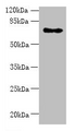 Western blot; All lanes: ZNF133 antibody at 5µg/ml + Hela whole cell lysate; Secondary; Goat polyclonal to rabbit IgG at 1/10000 dilution; Predicted band size: 74, 63, 67 kDa; Observed band size: 74 kDa Western blot; All lanes: ZNF133 antibody at 5µg/ml + Hela whole cell lysate; Secondary; Goat polyclonal to rabbit IgG at 1/10000 dilution; Predicted band size: 74, 63, 67 kDa; Observed band size: 74 kDa