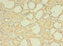 Immunohistochemistry of paraffin-embedded human kidney tissue using CAC08981 at dilution of 1:100 Immunohistochemistry of paraffin-embedded human kidney tissue using CAC08981 at dilution of 1:100
