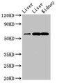 Western Blot; Positive WB detected in: Rat liver tissue, Mouse liver tissue, Mouse kidney tissue; All lanes: ZNF695 antibody at 3.4µg/ml; Secondary; Goat polyclonal to rabbit IgG at 1/50000 dilution; Predicted band size: 61, 21, 16, 11 kDa; Observed band size: 61 kDa; Western Blot; Positive WB detected in: Rat liver tissue, Mouse liver tissue, Mouse kidney tissue; All lanes: ZNF695 antibody at 3.4µg/ml; Secondary; Goat polyclonal to rabbit IgG at 1/50000 dilution; Predicted band size: 61, 21, 16, 11 kDa; Observed band size: 61 kDa;