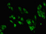 Immunofluorescent analysis of Hela cells using CAC09005 at dilution of 1:100 and Alexa Fluor 488-congugated AffiniPure Goat Anti-Rabbit IgG(H+L) Immunofluorescent analysis of Hela cells using CAC09005 at dilution of 1:100 and Alexa Fluor 488-congugated AffiniPure Goat Anti-Rabbit IgG(H+L)