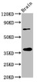 Western Blot; Positive WB detected in: Rat brain tissue; All lanes: EIF3I antibody at 3.2µg/ml; Secondary; Goat polyclonal to rabbit IgG at 1/50000 dilution; Predicted band size: 37 kDa; Observed band size: 37 kDa Western Blot; Positive WB detected in: Rat brain tissue; All lanes: EIF3I antibody at 3.2µg/ml; Secondary; Goat polyclonal to rabbit IgG at 1/50000 dilution; Predicted band size: 37 kDa; Observed band size: 37 kDa